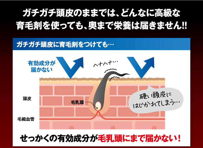 ガチガチ頭皮のままでは、どんなに高級な育毛剤を使っても、奥まで栄養は届きません！！