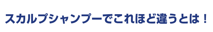 スカルプシャンプーでこれほど違うとは！